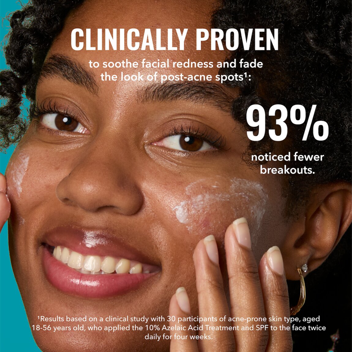 Good Molecules 10% Azelaic Acid Treatment 30ml alternative view 7.